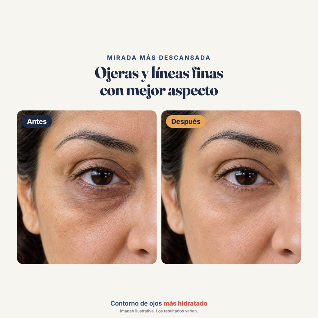 Antes y después ilustrativo del contorno de ojos