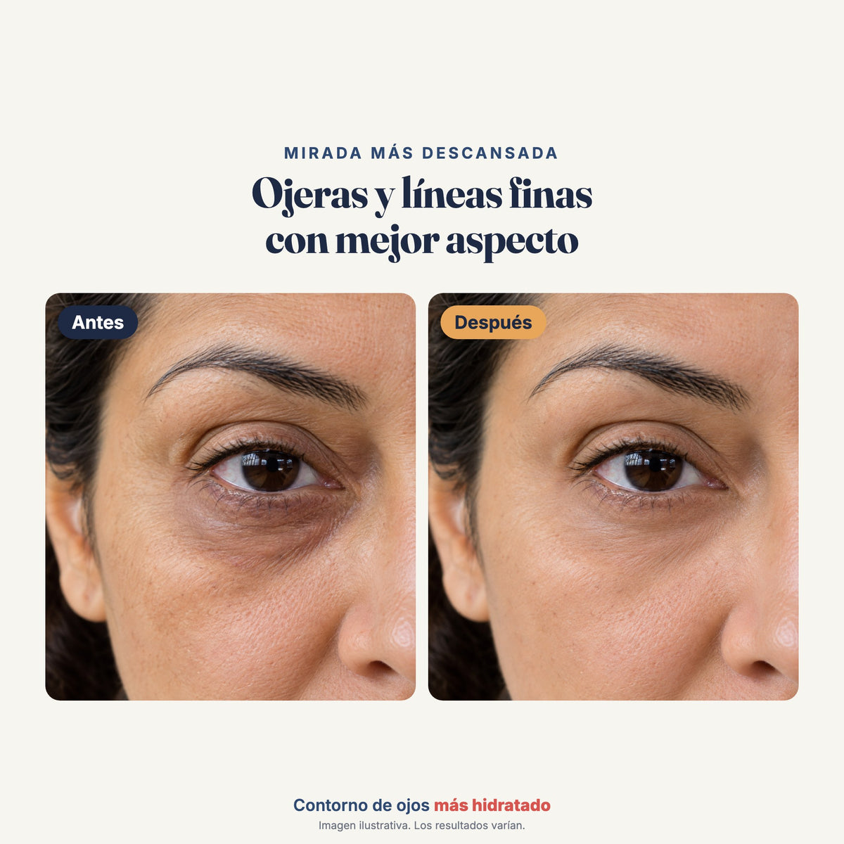 Antes y después ilustrativo del contorno de ojos